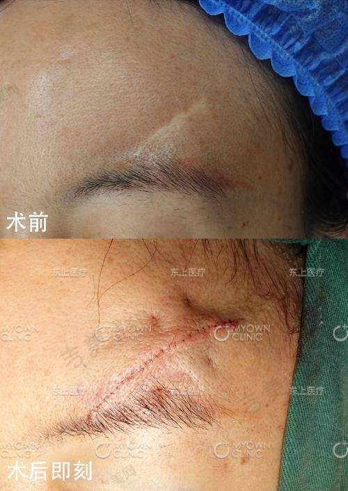 深圳安美聚光医疗美容门诊部的丰富项目