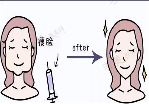 泉州美莱华美医疗美容医院隆胸优势