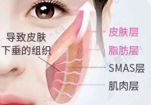 泉州东大医疗美容医院隆胸优势