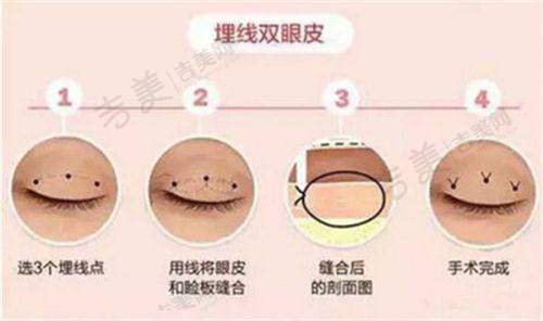 大理伊美东方丽人整形价格合理性分析