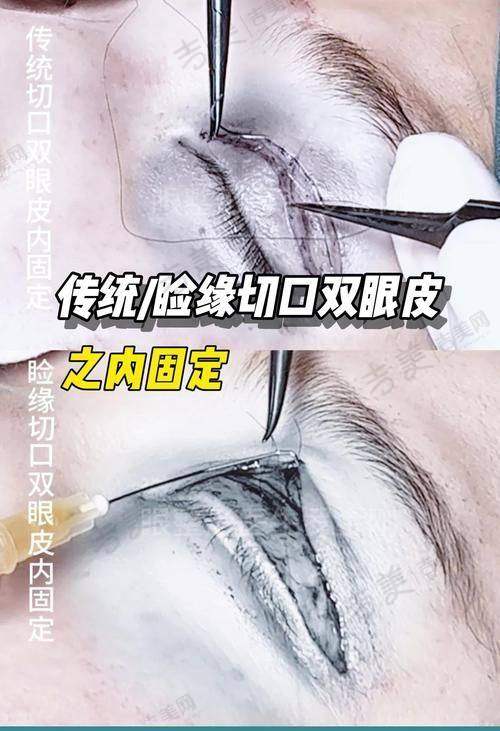 泉州东大整形美容医院实力