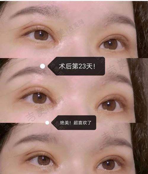 泉州脂管加医疗美容门诊部特色