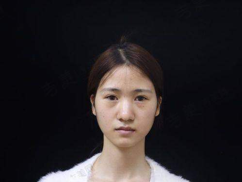大理伊美东方丽人整形价格详情