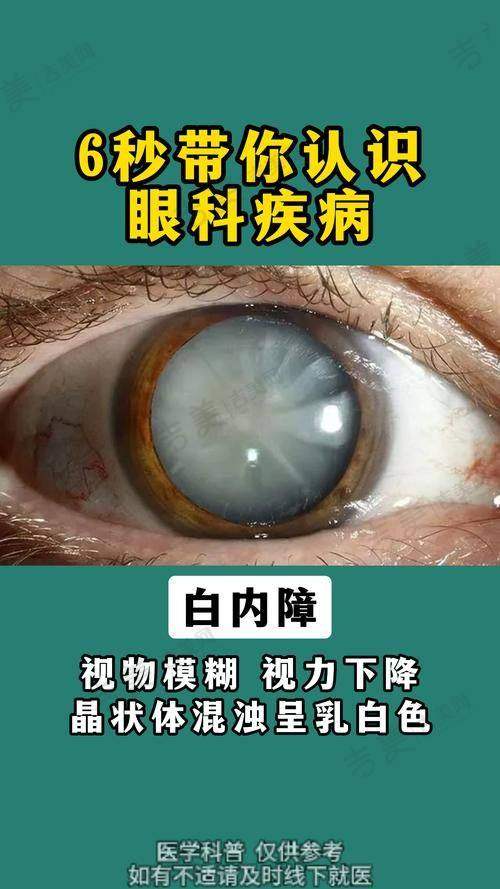 六、广元爱尔眼科医院地址及路线指引