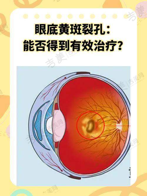 三、广元爱尔眼科医院口碑评价如何