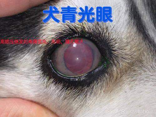 四、宿州爱尔眼科医院项目特色:多样项目满足不同患者需求
