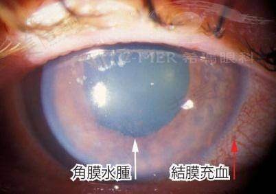 合肥爱尔眼科医院项目特色：多样项目满足不同需求