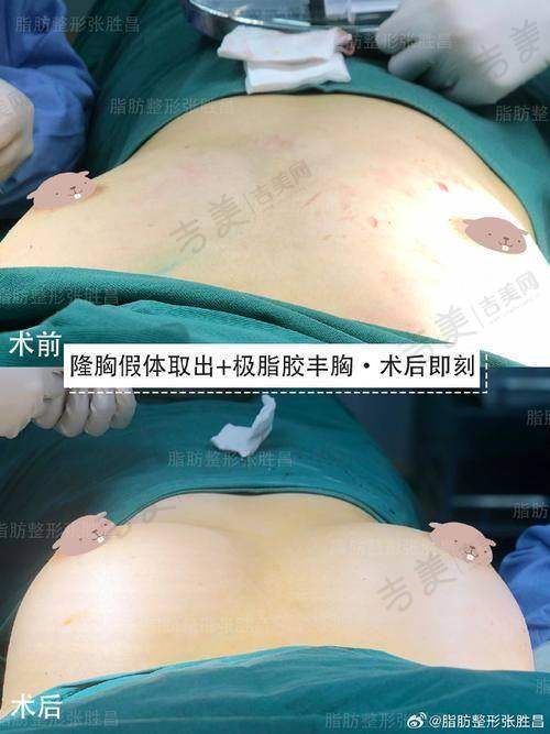 泉州美莱华美医疗美容医院综合优势
