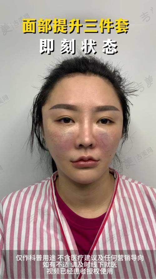 成都素美医疗美容门诊部李建钢医生医生技艺看口碑咋样