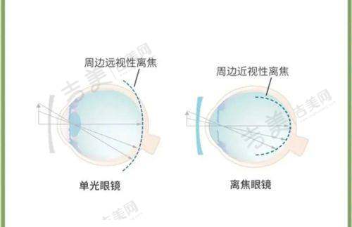 嘉兴爱尔眼科医院的靠谱医生团队