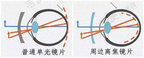 嘉兴爱尔眼科医院的服务体验
