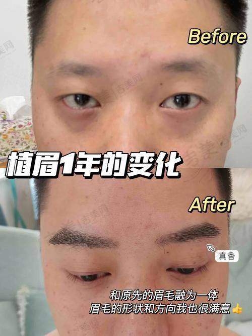 武汉紫荆医院整形科怎么样，口碑评价如何