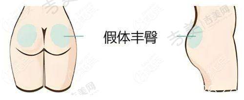 广州查尔曼新颜医疗美容门诊部地址在哪里