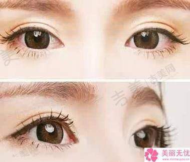李威医生口碑如何
