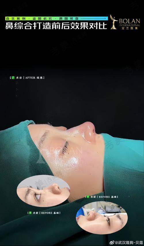 马君医生实例