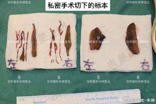 二、刘菡医生简历:童颜炮、超声炮、热玛吉等医美技术的积累之路