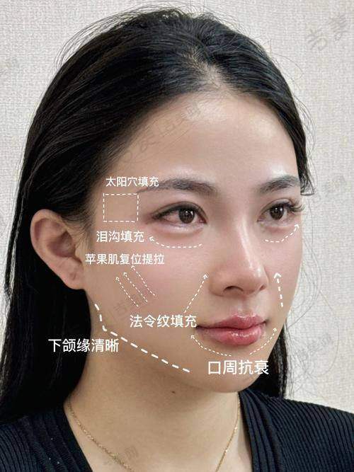 秦珊医生顾客实例图片