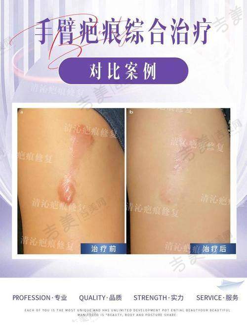 海口鹏爱医疗美容门诊部顾客实例