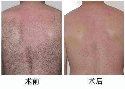 西双版纳莱尚整形医院口碑好不好？附真实患者口碑评价