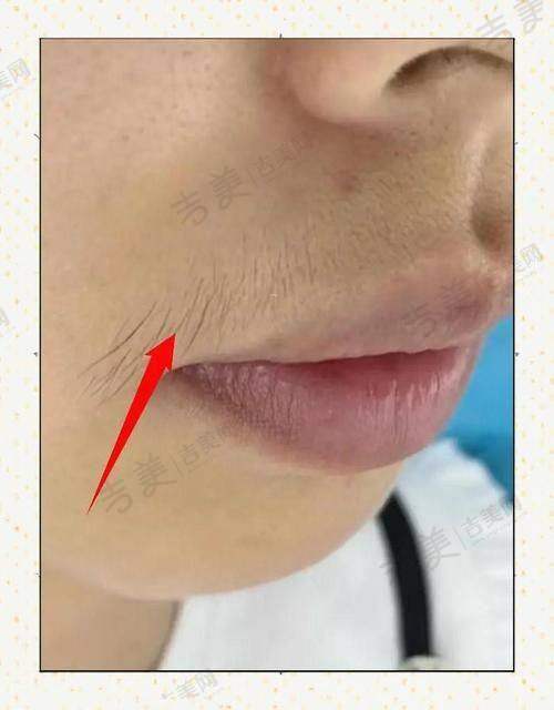 海口鹏爱医疗美容门诊部更擅长什么