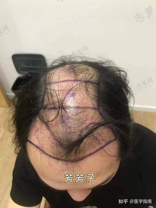 海口鹏爱医疗美容门诊部怎么样