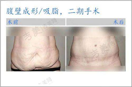 李方医生与特色项目