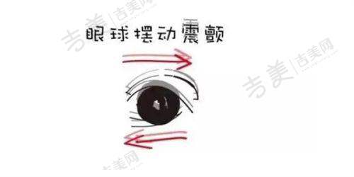 兰州普瑞眼科医院具体营业时间