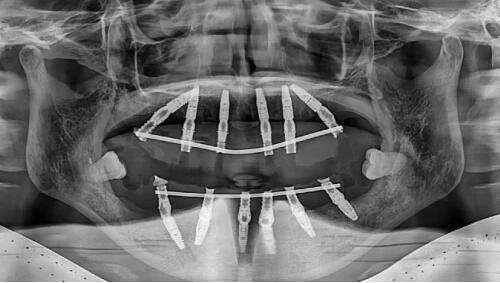 苏州白癜风更厉害医生之苏州市立医院
