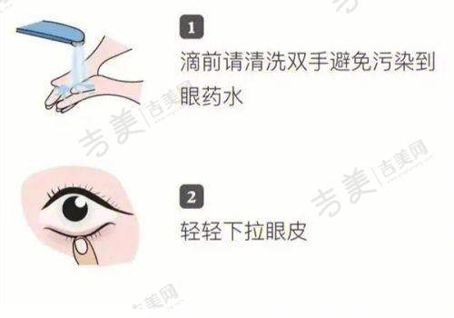 四川大学华 西医院眼科与成都睛彩眼科医院对比