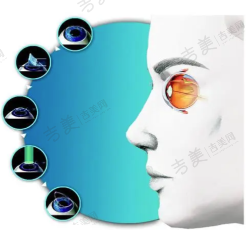 四川大学华 西医院眼科2025年眼部其他疾病治疗价格