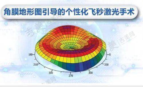 重庆南坪爱尔眼科医院擅长项目