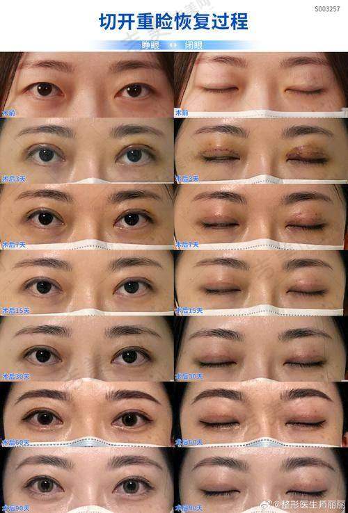 苏州接睫毛比较好的医院——苏州美贝尔美容医院