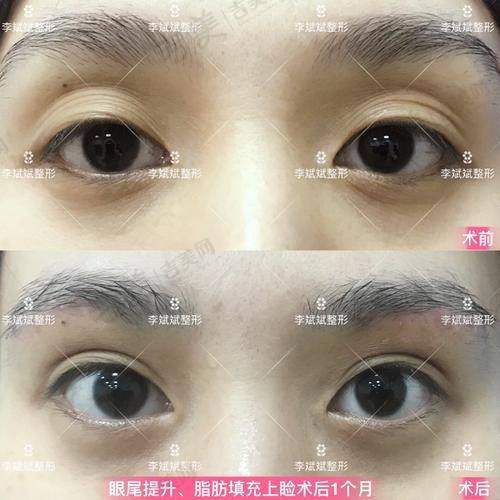 苏州接睫毛比较好的医院——苏州吴中维多利亚美容医院