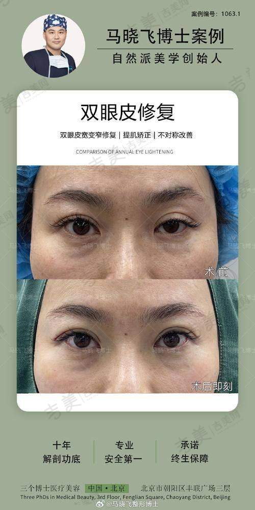 苏州接睫毛比较好的医院——昆山市负责人民医院