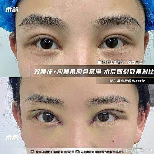 苏州接睫毛比较好的医院——张家港市第一人民医院烧伤整形科