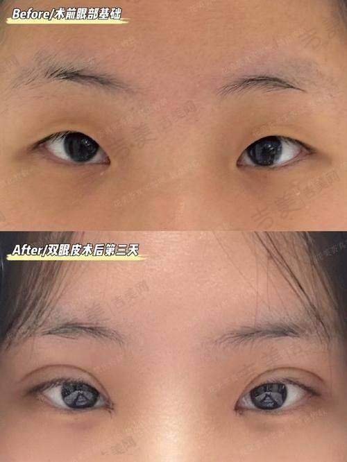 苏州接睫毛比较好的医院——苏州大学附属第二医院整形美容外科