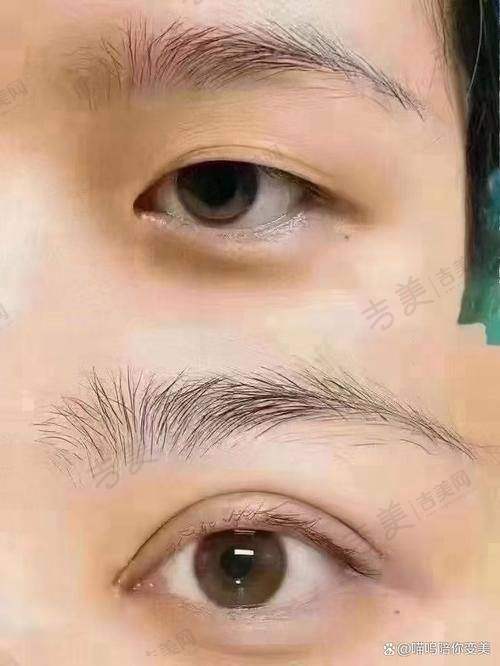 苏州接睫毛比较好的医院——苏州市立医院整形外科