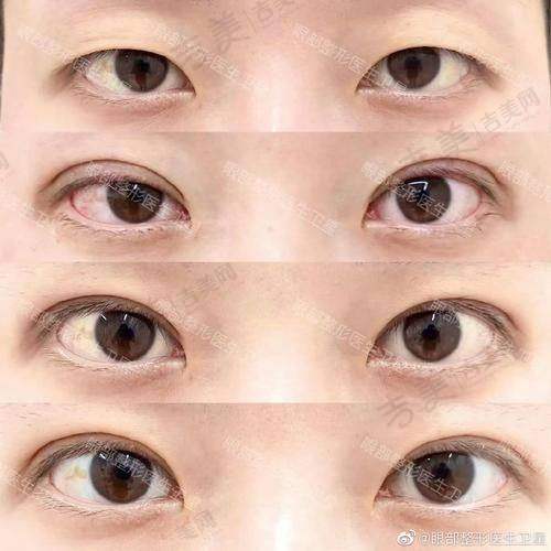 苏州接睫毛比较好的医院——苏州同济医院整形美容科