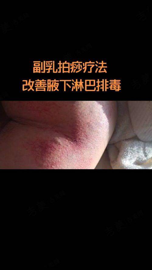 苏州奥美定取出好的医院排名榜——苏州市第五人民医院医学美容科