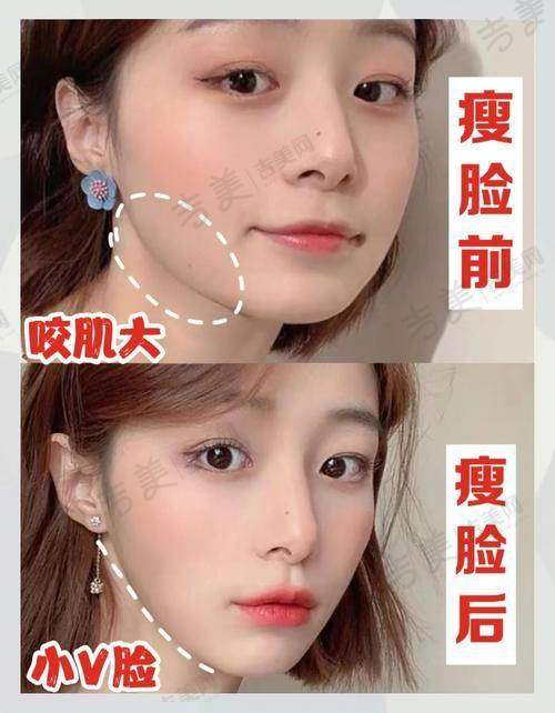 苏州面部不对称矫正医生排名——江苏昆山铂特丽医疗美容