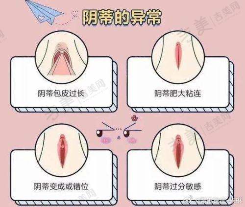 苏州男性私密整形医生哪个好——苏州吴州中医和西医结合医院私密整形科