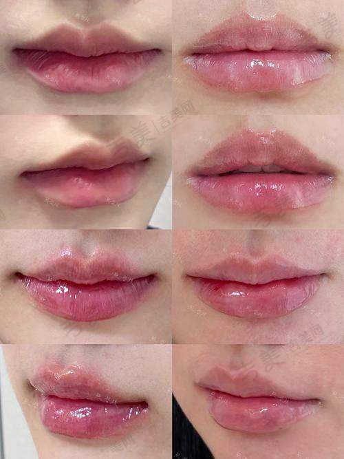 苏州人中缩短更受欢迎的医院——北京蕾士悦容医疗美容门诊部