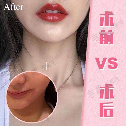 苏州人中缩短更受欢迎的医院——上海丽质医疗美容门诊部