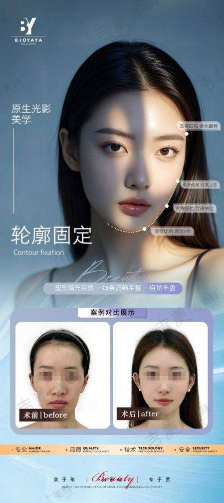 苏州玻尿酸垫下巴医生十大排名——昆山星范医疗美容门诊有限公司