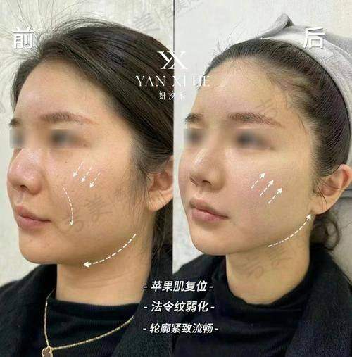 苏州男性私密整形医生哪个好——苏州第一人民医院整形美容科