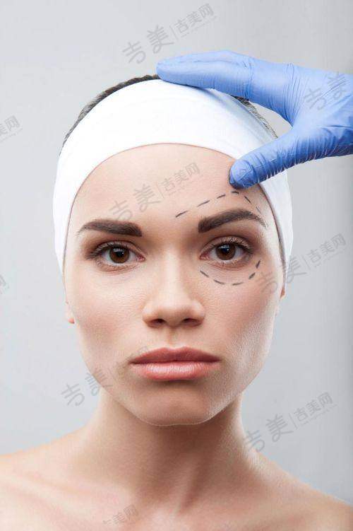 苏州大拉皮骨干医生排名前十——苏州泰美丽医疗美容医院