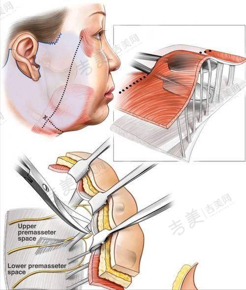 苏州大拉皮骨干医生排名前十——苏州美贝尔美容医院