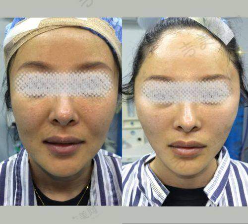 苏州大拉皮骨干医生排名前十——苏州常春藤医疗美容诊所