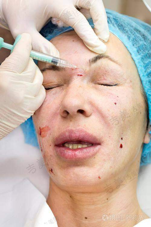 苏州接睫毛比较好的医院——苏州美立方医疗美容