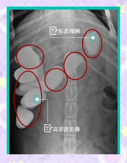 苏州奥美定取出好的医院排名榜——苏州整形美容医院
